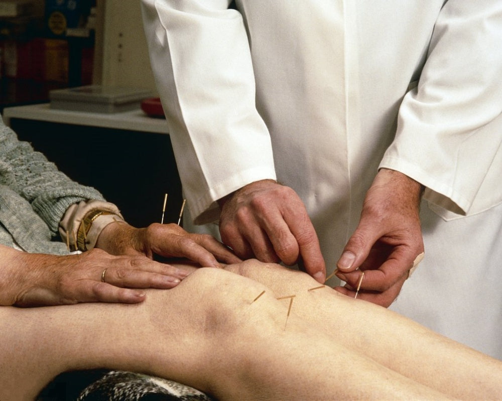 Comparing Red Light Therapy and Acupuncture for Pain Relief