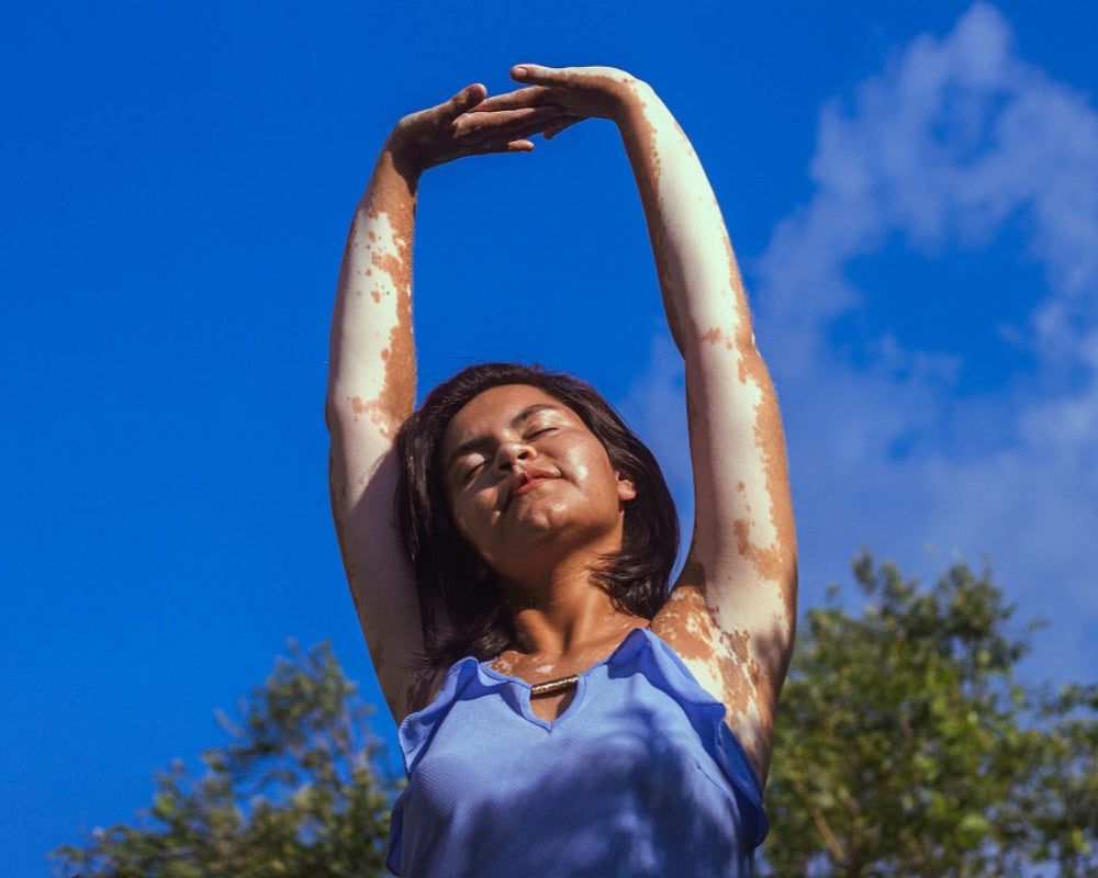 Can UVB Phototherapy Treat Vitiligo?