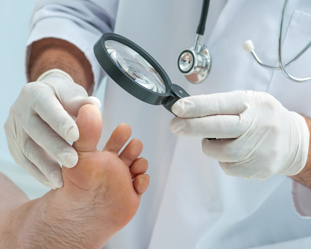 Is Onychomycosis Contagious?