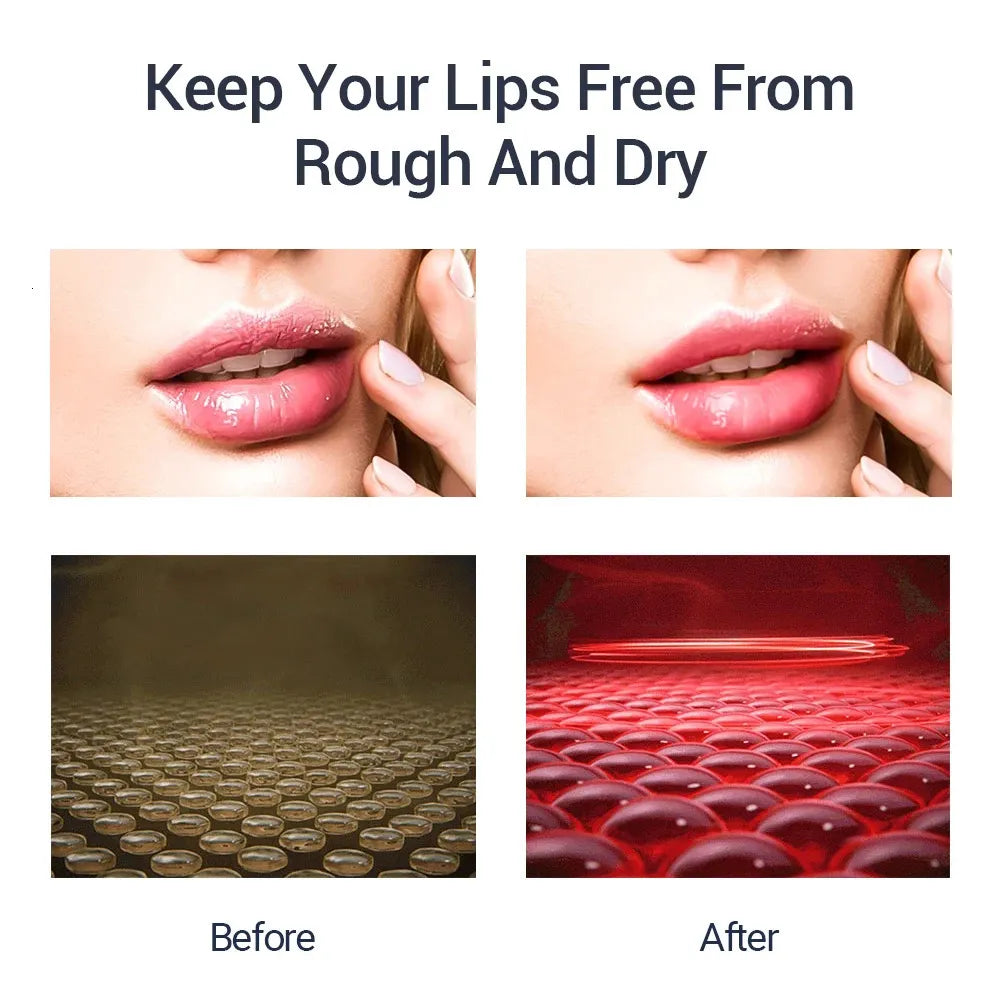 Lip Plumper Device