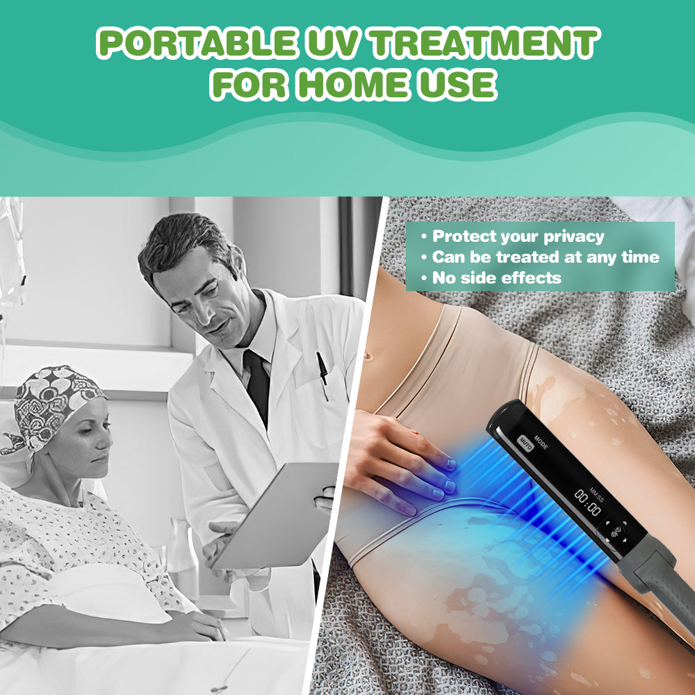 311nm UVB light therapy treatment for psoriasis vitiligo
