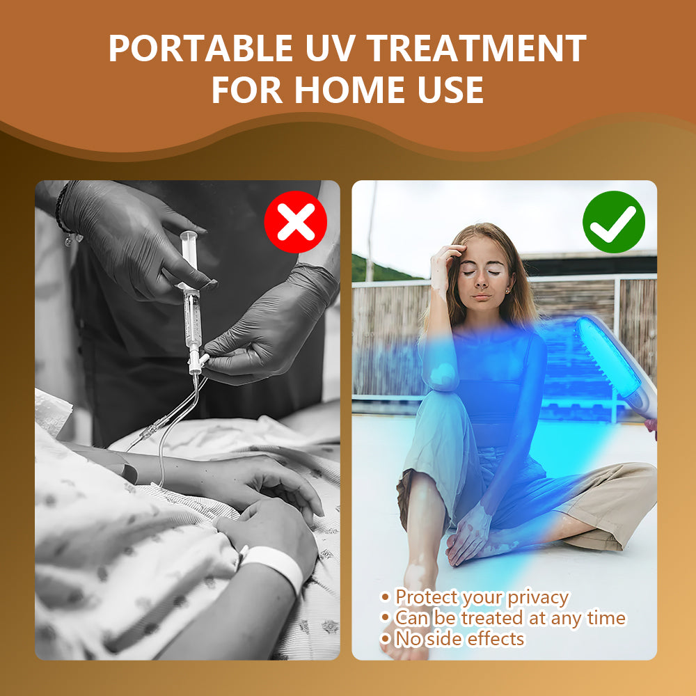 CE approved UVB Phototherapy Manufacture OEM Support for vitiligo treatment