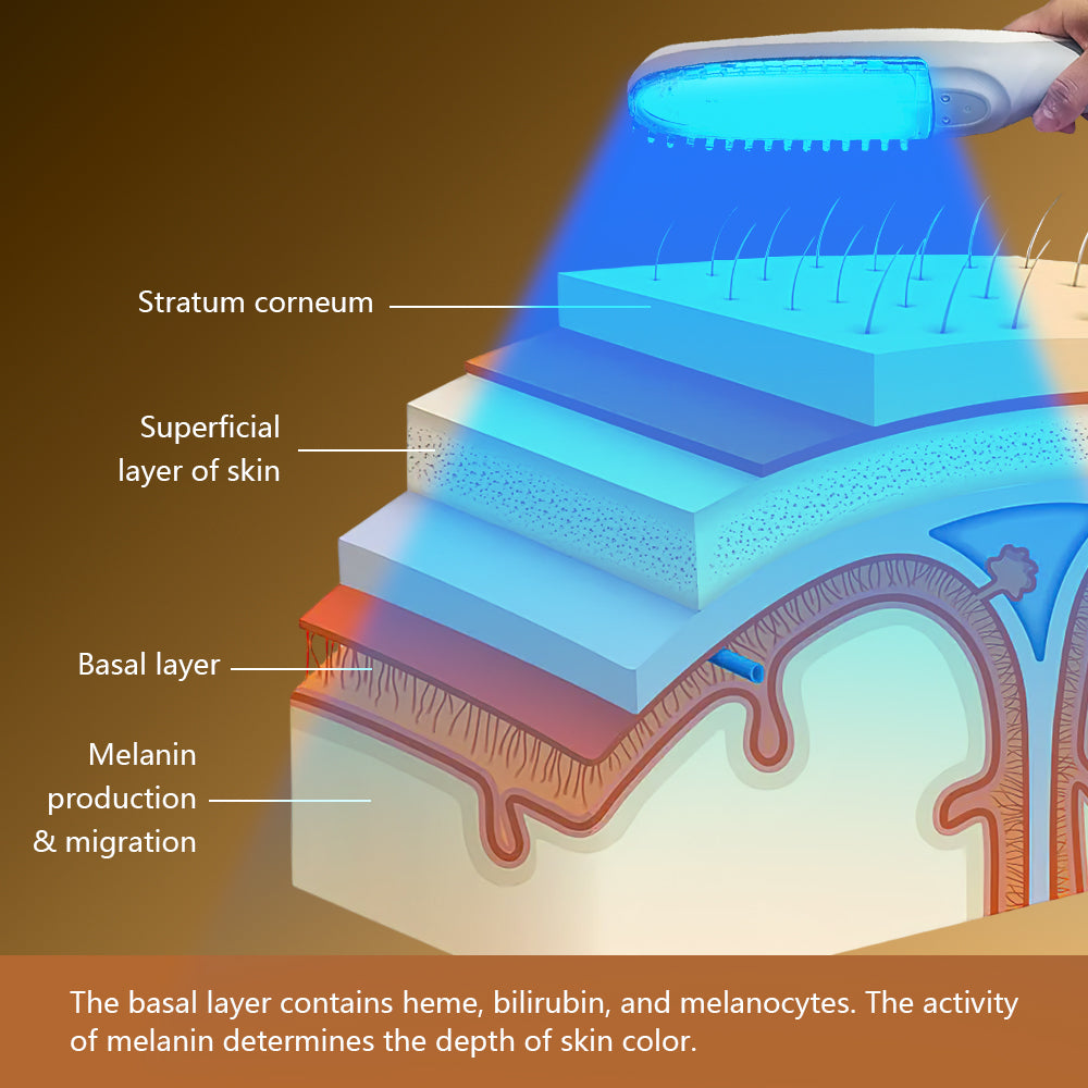 CE approved UVB Phototherapy Manufacture OEM Support for vitiligo treatment