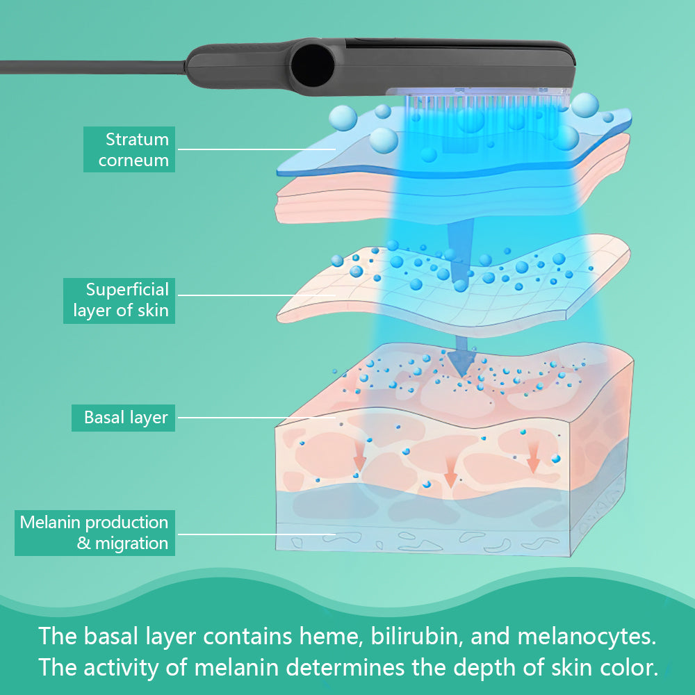 311nm UVB light therapy treatment for psoriasis vitiligo