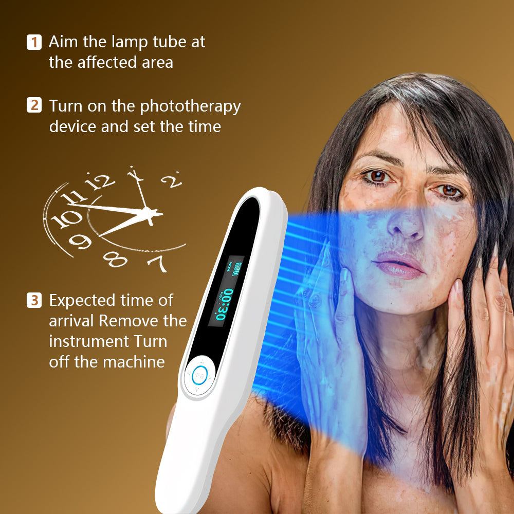 CE approved UVB Phototherapy Manufacture OEM Support for vitiligo treatment