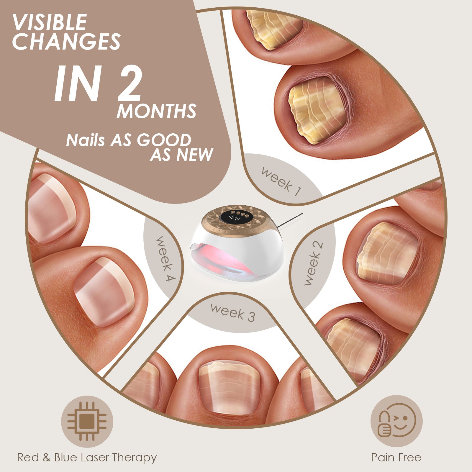 Gold KTS Nail Fungus Light for Multiple Toenail