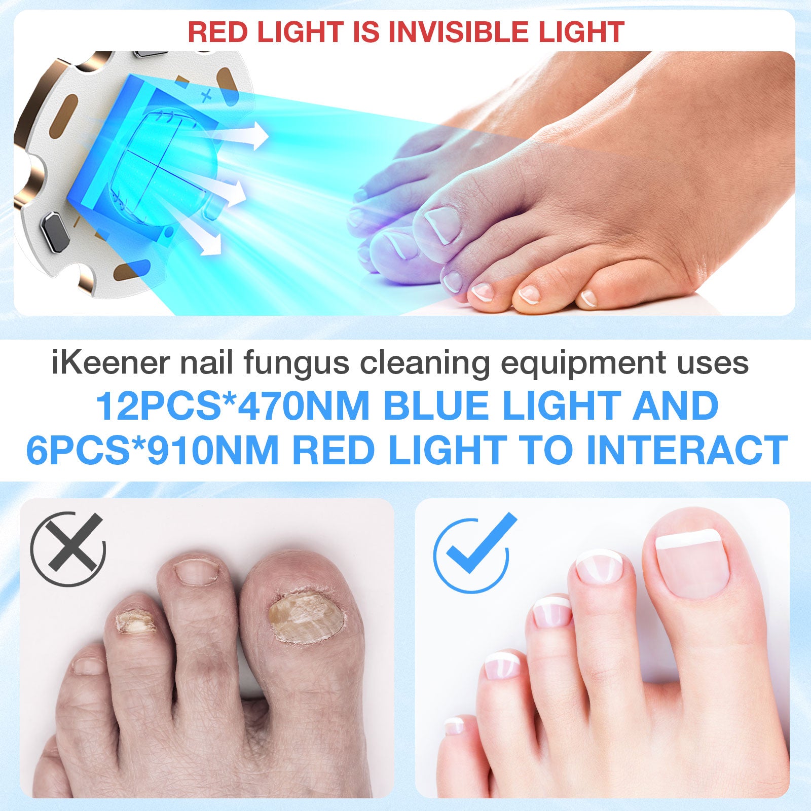 Nail Fungus Light for Multiple Toenail