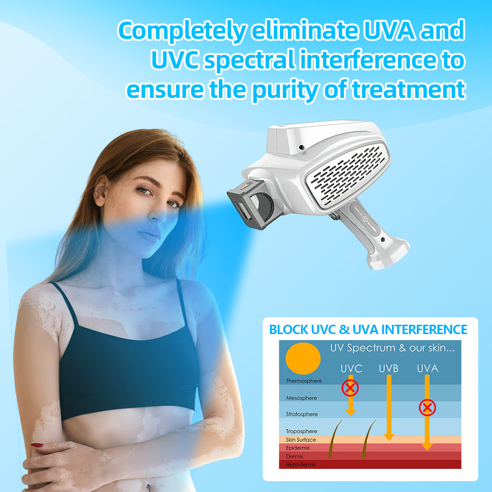 KTS 308nm UVB excimer light therapy apparatus