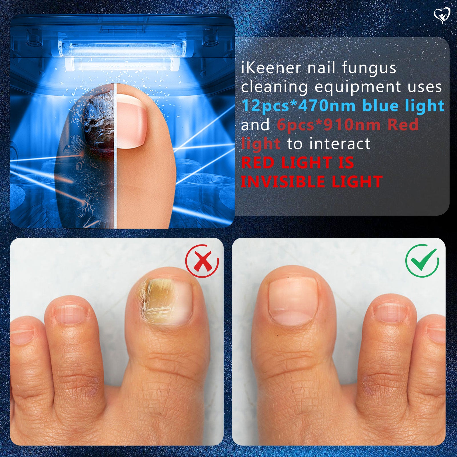 Nail Fungus Light for Multiple Toenail