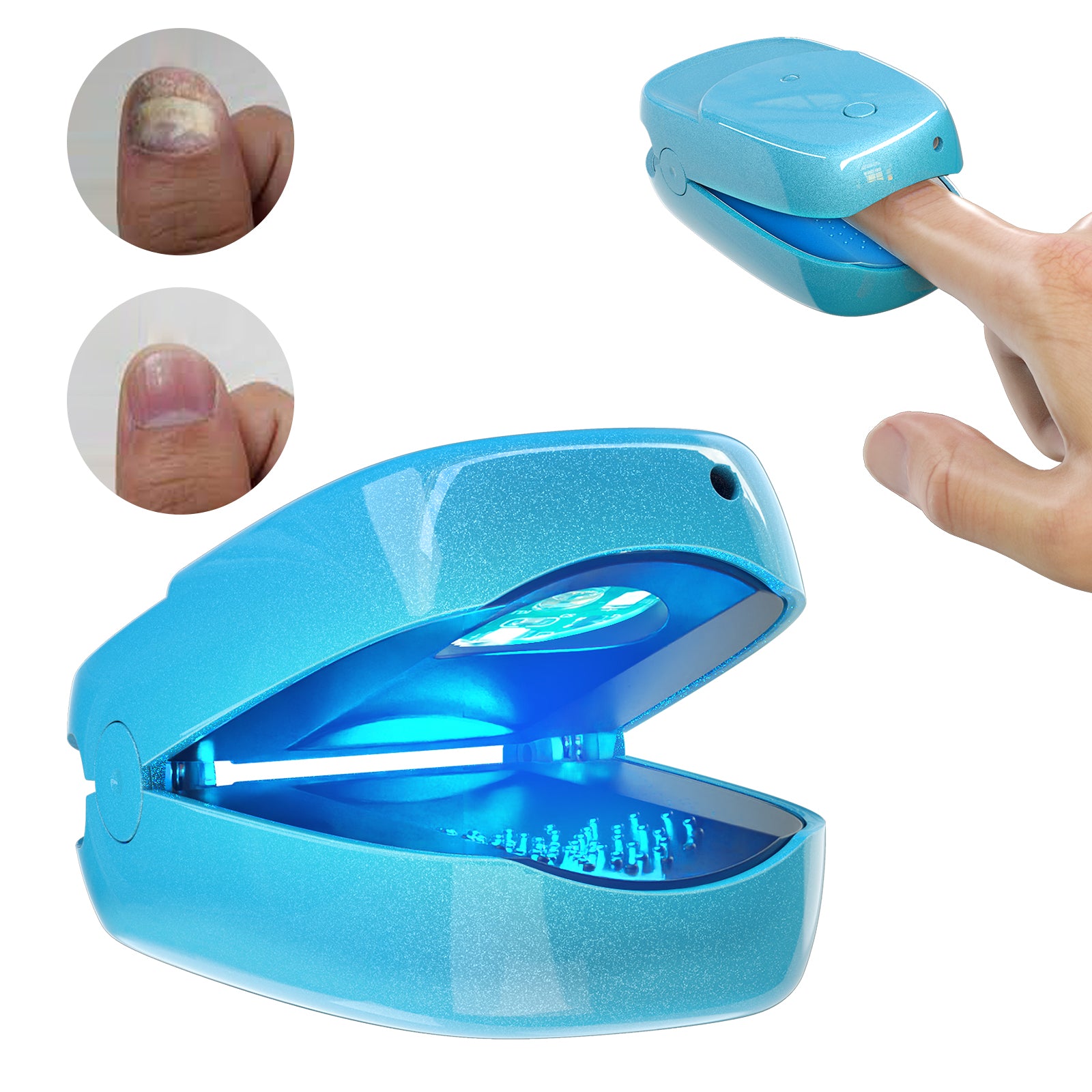 FDA Cleared Portable Laser Therapy Nail Cleaning Device