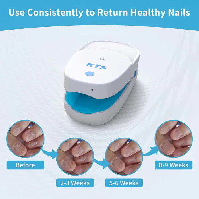 2pics KTS® Nail Fungus Laser Treatment Devices