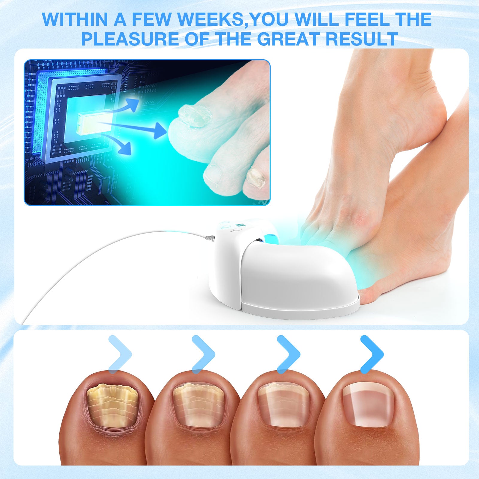 Nail Fungus Light for Multiple Toenail