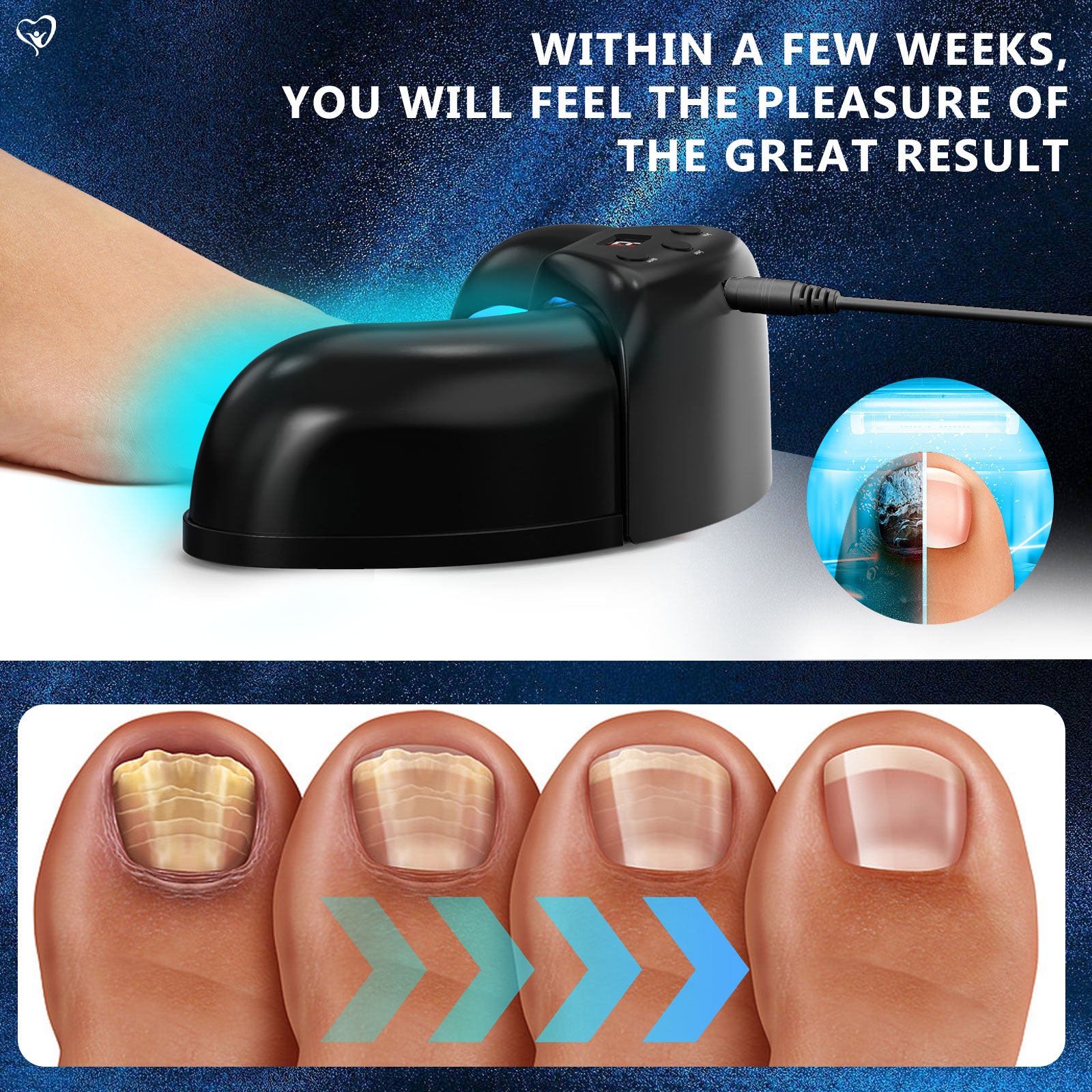 Nail Fungus Light for Multiple Toenail