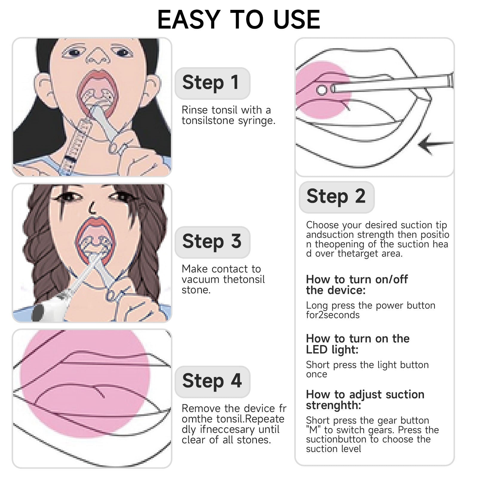 KTS Tonsil Stone Removal Kit with Irrigation Syringe