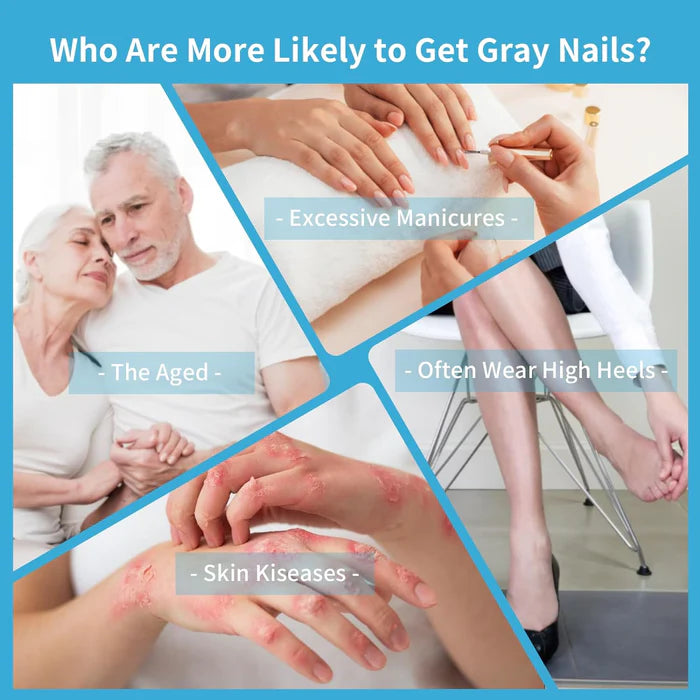 KTS® Nail Fungus Laser Treatment Device Collection