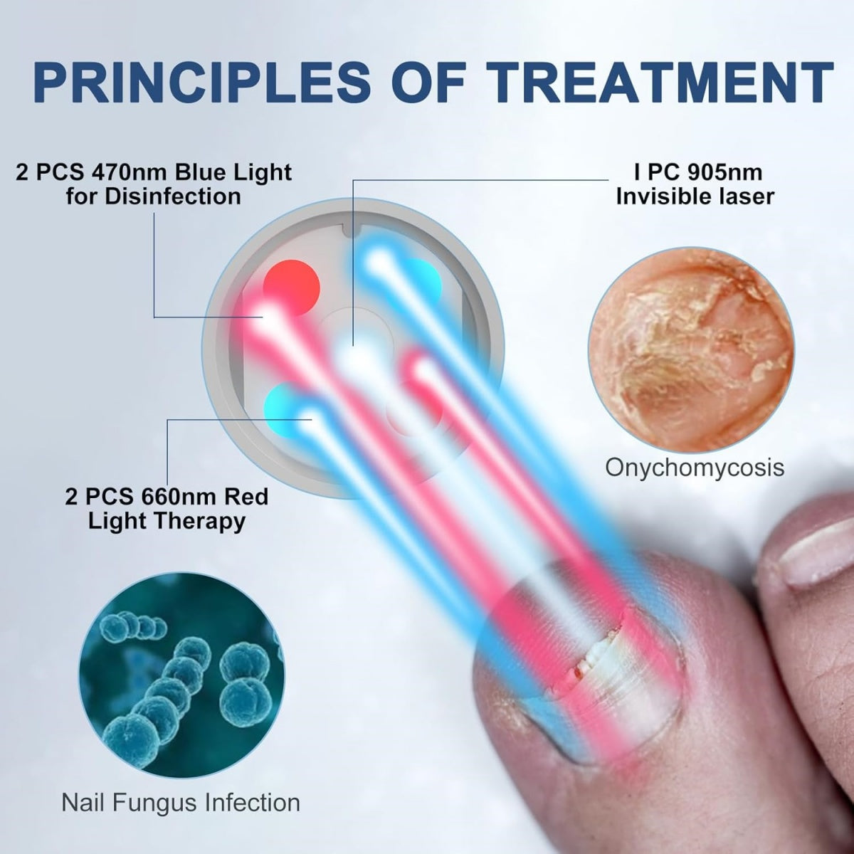KTS Fungal Nail Treatment Device