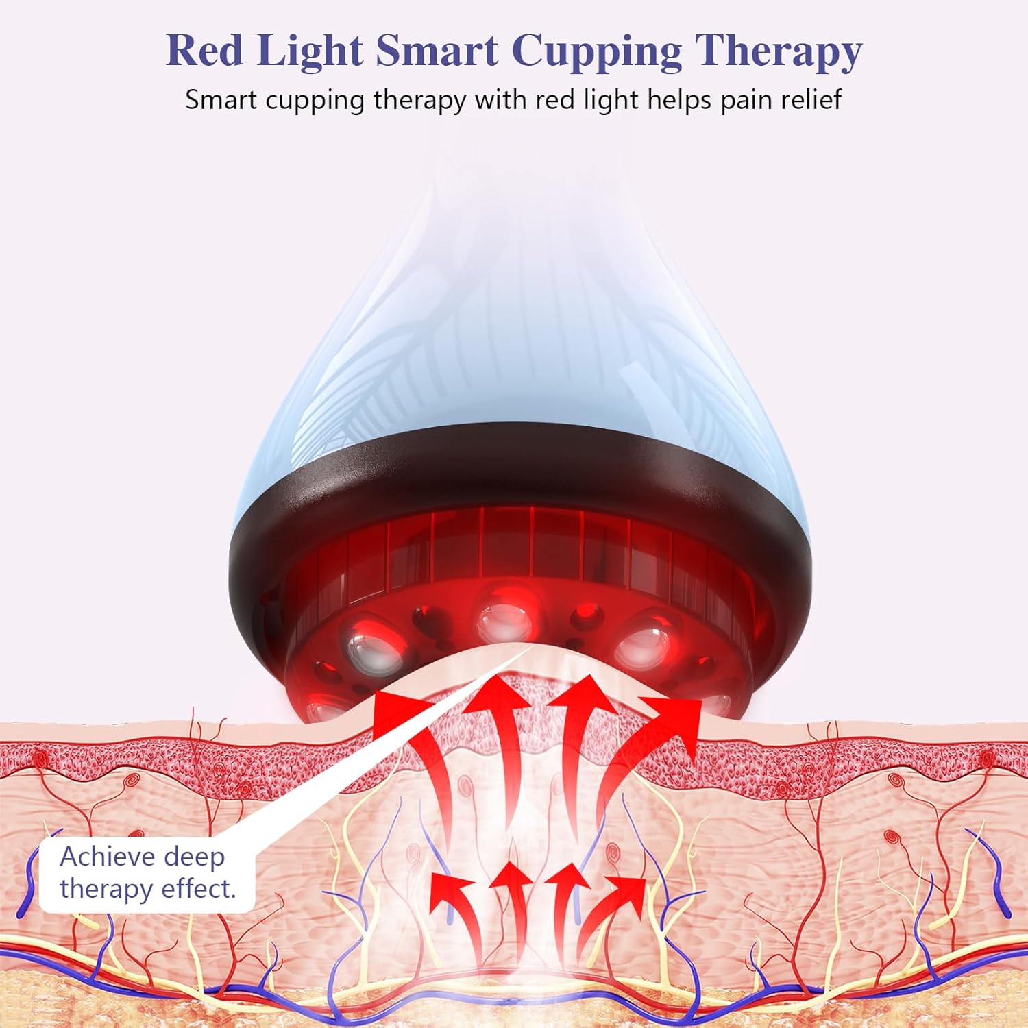 KTS® Electric Cupping Treatment