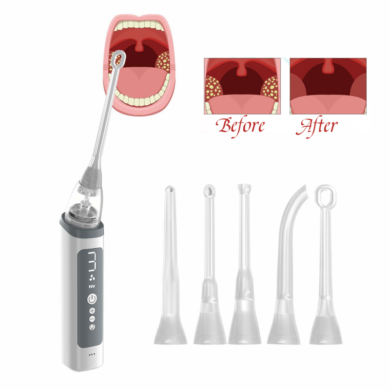 KTS Tonsil Stone Removal Kit with Irrigation Syringe