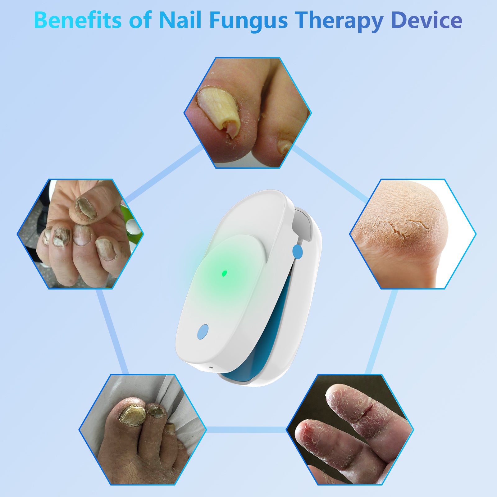 FDA Cleared Portable Laser Therapy Nail Cleaning Device