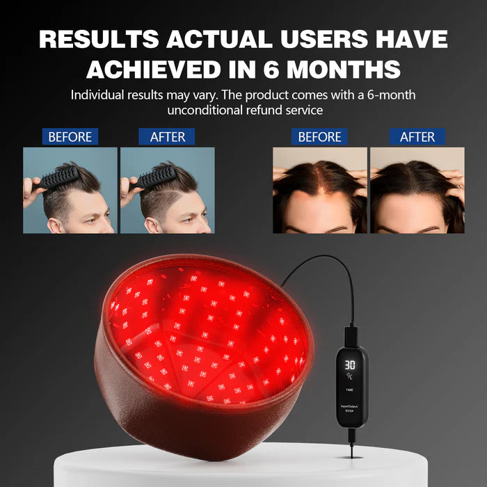 KTS® Laser Hair Regrowth Cap 1.0 Pro