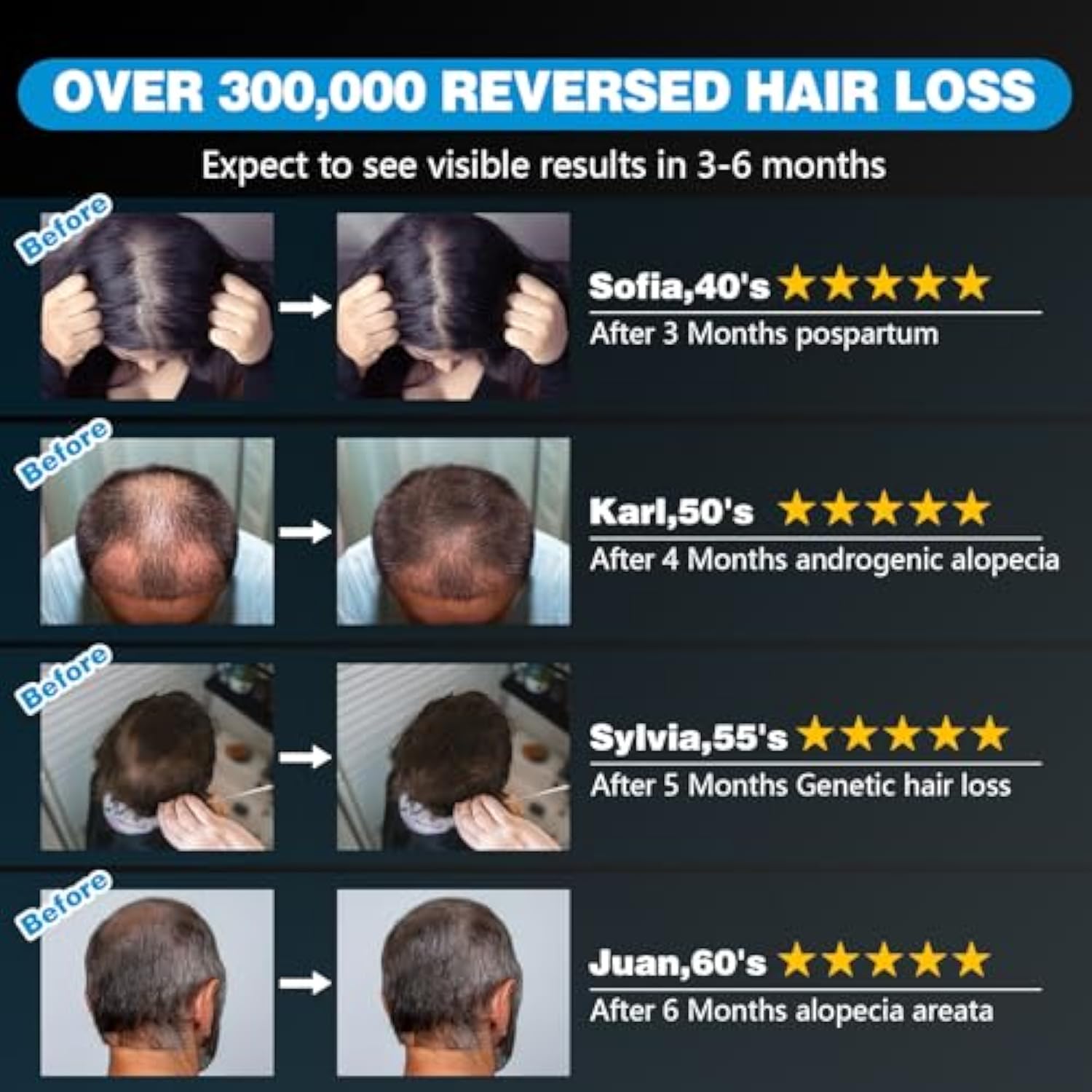 KTS® Laser Hair Regrowth Cap 1.0 Pro