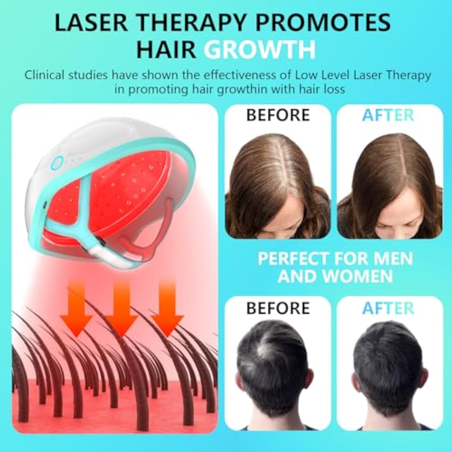 Red Light Helmet For Hair Regrowth(Cordless Device)