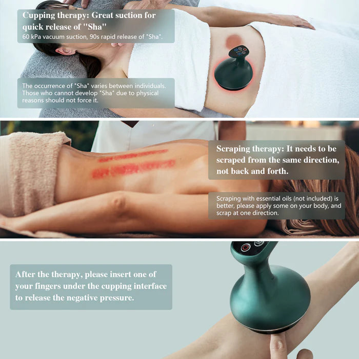 KTS® 3-in-1 Cupping Treatment Kit