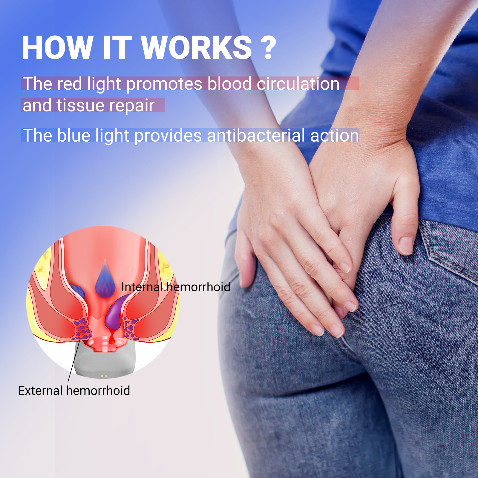 Portable Laser Hemorrhoids Treatment Device