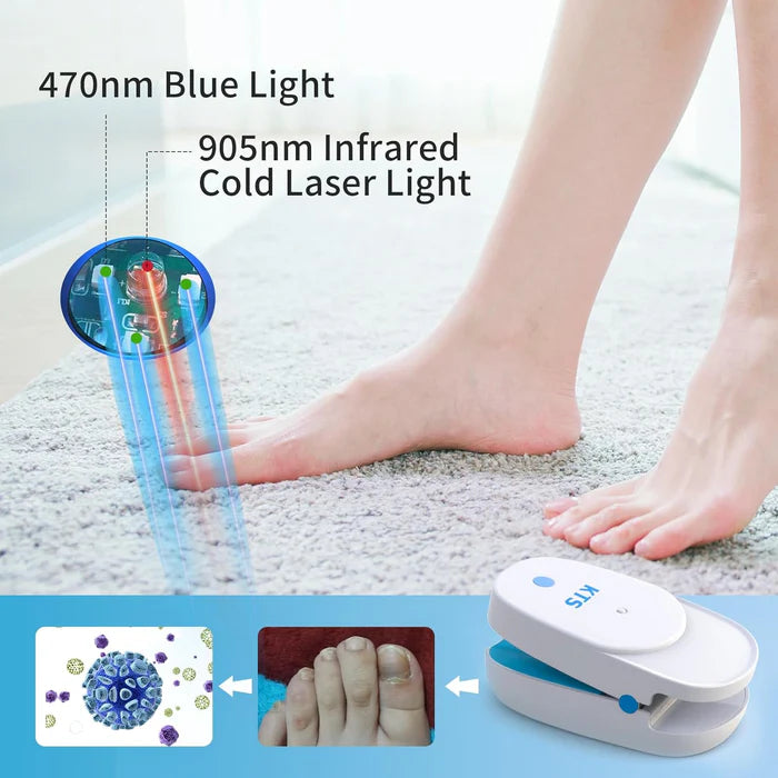 KTS® Nail Fungus Laser Treatment Device Collection