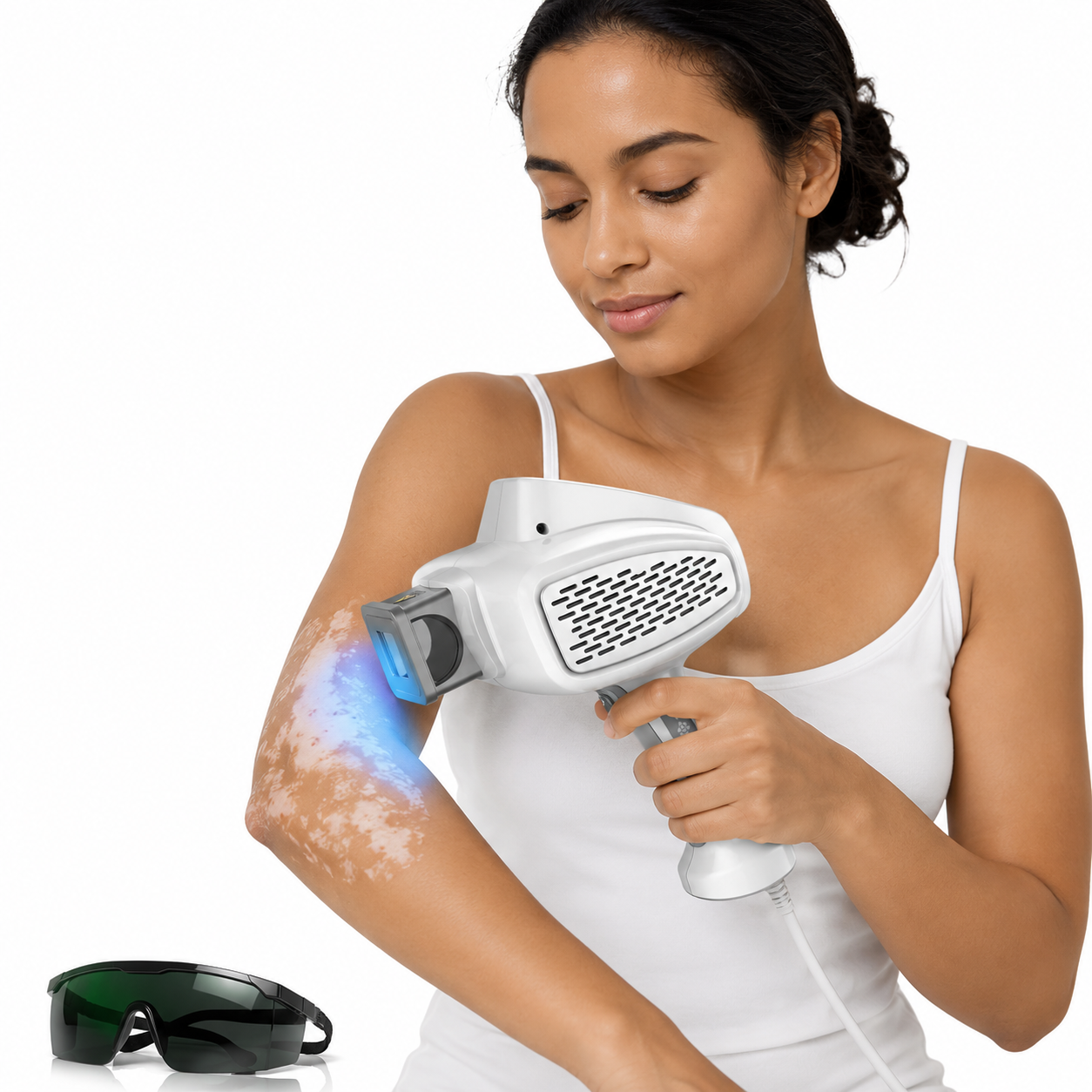 KTS 308nm UVB excimer light therapy apparatus